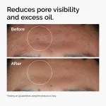 Niacinamide 10% + Zinc 1% - Image 4